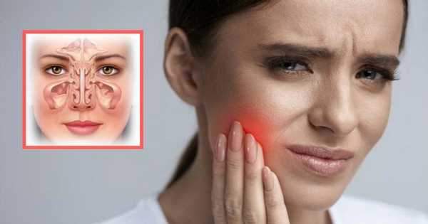 ¿Es posible que la sinusitis genere dolor dental