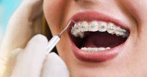 Factores relevantes para utilizar ortodoncia