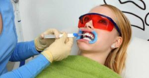 Los blanqueamientos dentales tienen efectos secundarios