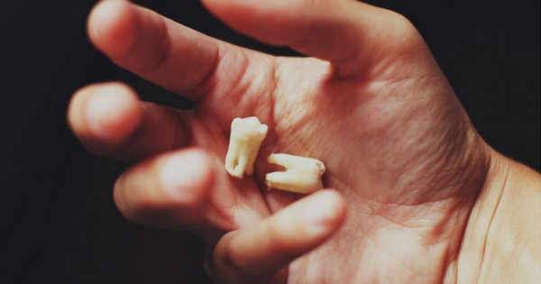 Perdiste uno o varios dientes Entérate de las consecuencias ocultas