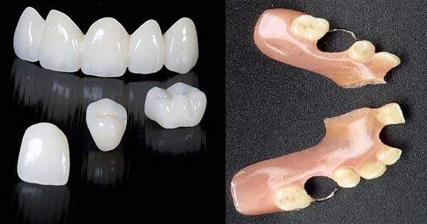 Protesis Dentales