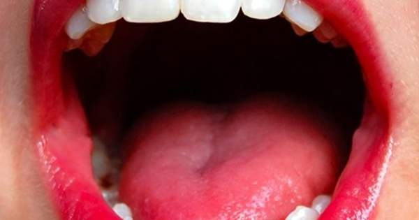 ¿Qué pruebas sirven para diagnosticar el cáncer oral?