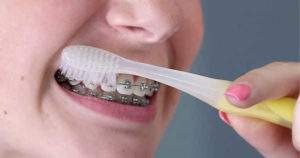 ¿Sabes cómo cepillar tus dientes con brackets