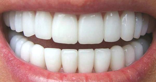 Técnicas para corregir la posición de los dientes