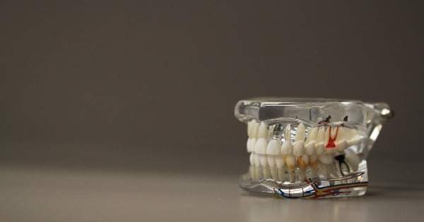 Todo lo que debes saber sobre los implantes dentales modernos